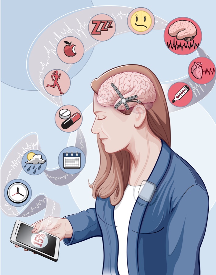 Illustration of a person with a wearable brain monitor and multiple physiological data streams, for the circadian profile of epilepsy paper