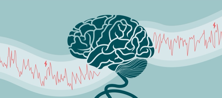 Illustration of a brain over an EEG-style trace, for the 2018 Lancet Neurology paper